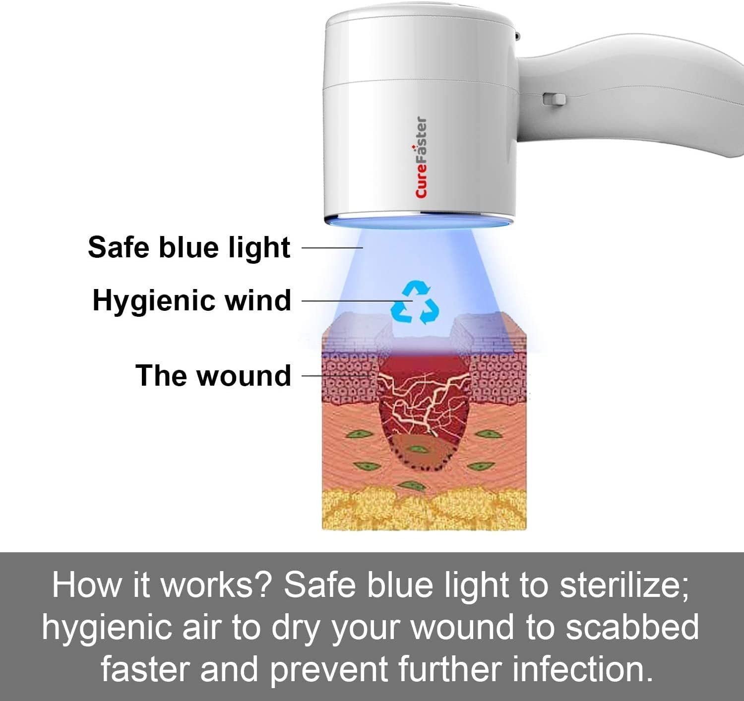 Wound Care Patient Care to Help Acute and Chronic Wound Seal Closure for Elders,Diabetes, Bedsore,Pressure Sore Healing and Skin Immune Ulcer Disease