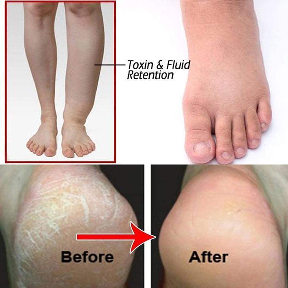 10Pcs Ginger Foot  Hand Salts  Soaks Foot Care,Eliminate Fatigue Improve Sleeping Foot Pain Foot Care Treatment