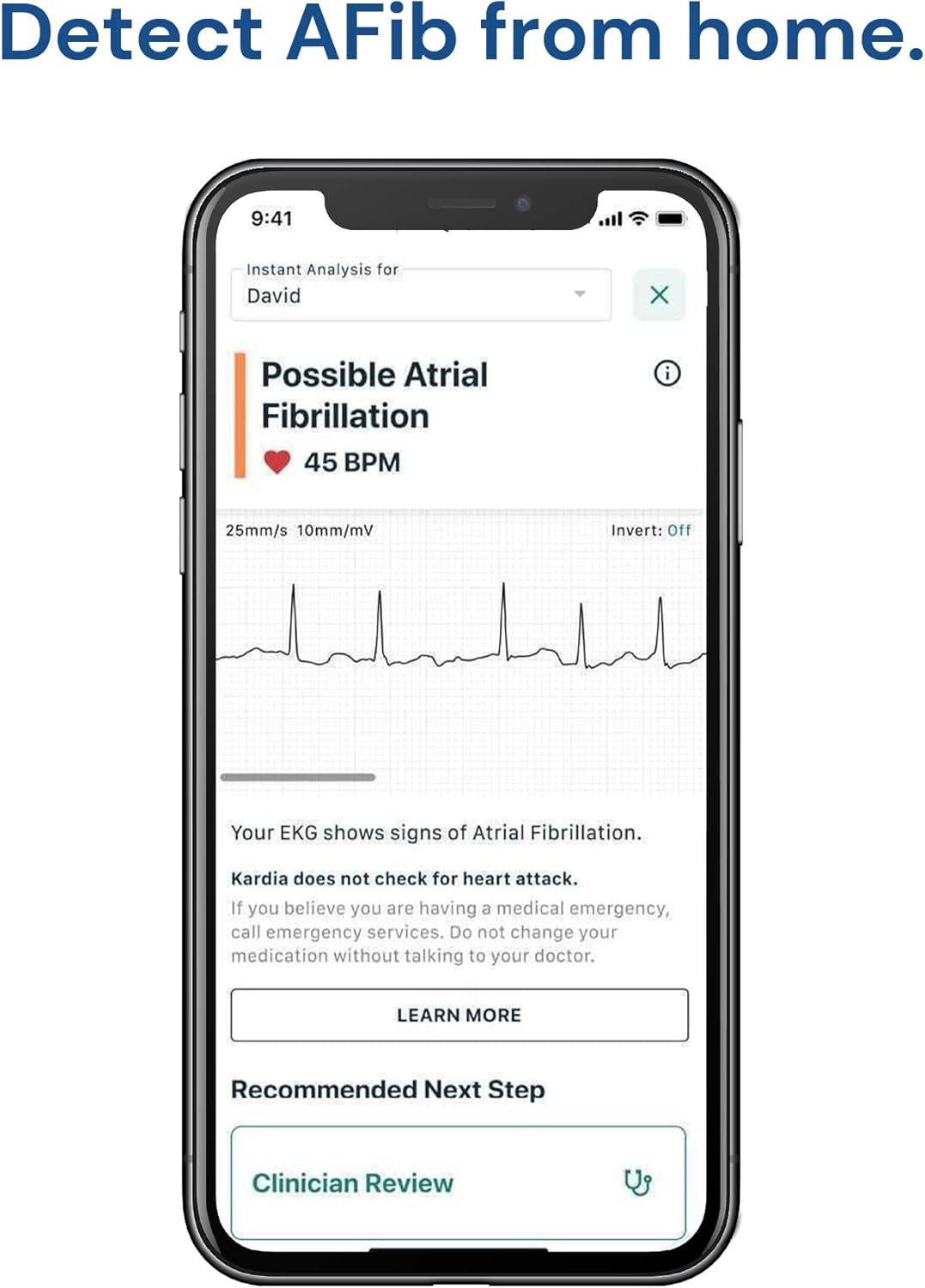 KardiaMobile 1-Lead Personal EKG Monitor – Record at Home – Detects AFib  Irregular Arrhythmias – Easy Results in 30 Seconds – Works w/Most Smartphones - FSA/HSA Eligible